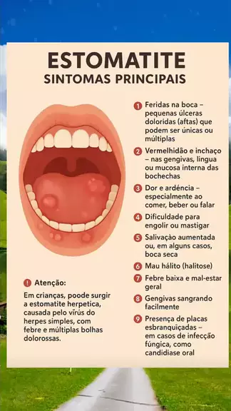 Estomatite