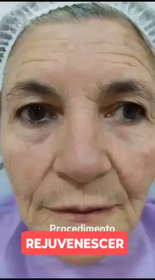 jubbilix fansly leak